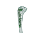 4.5mm Proksimal Tibia Lateral Anatomik Plak - Görsel 2