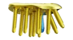 Distal Radius Volar Anatomik Plak - Görsel 6