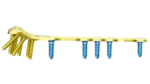 Distal Radius Volar Anatomik Plak - Görsel 5