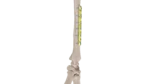 3.5mm Lcdpc Ulna, Radius Plak