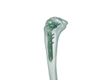 Proksimal Tibia Lateral (3.5) Anatomik Plak - Görsel 2